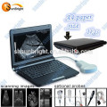 Laptop Veterinary Ultrasound for Swine Pregnancy Diagnosis